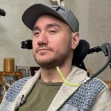 Čovek kome je ugrađen čip kompanije Ilona Maska za čitanje misli 4