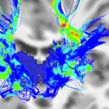Muškarci imaju veći rizik od Parkinsona: Naučnici otkrili da možda znaju i zašto 1