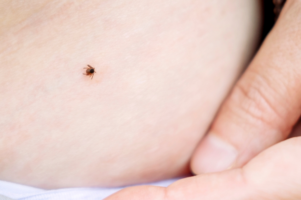 Uvukao vam se krpelj? Evo šta nikako ne smete da radite 1