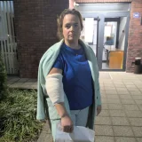 (FOTO) Ima ozbiljne povrede ruke: Novosađanka pogođena pirotehničkim sredstvom tokom akcije "Bukom protiv diktature" 2