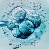 Australijanka rodila tuđe dete zbog greške na klinici 5