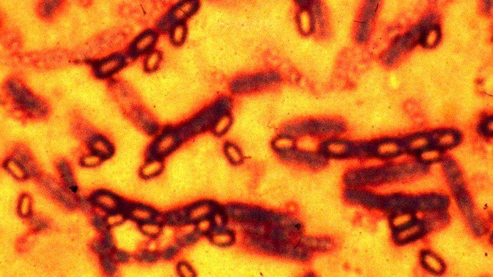 Šta je antraks i koliko je smrtonosan 1 antraks