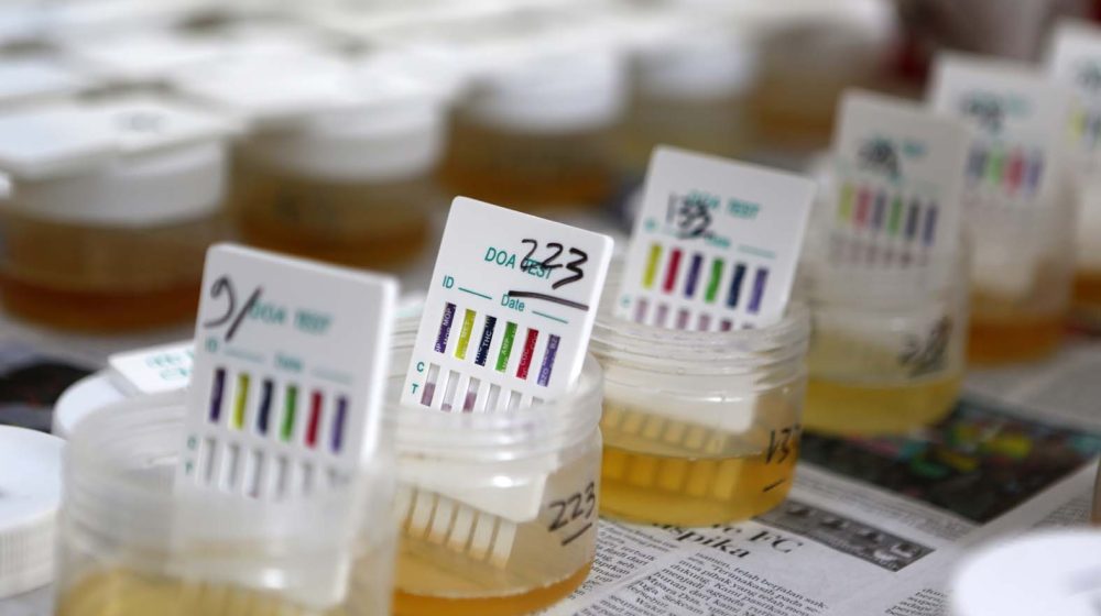 "Ko odbije - jasno je zašto": Test na drogu u niškoj Skupštini 1