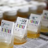 "Ko odbije - jasno je zašto": Test na drogu u niškoj Skupštini 12