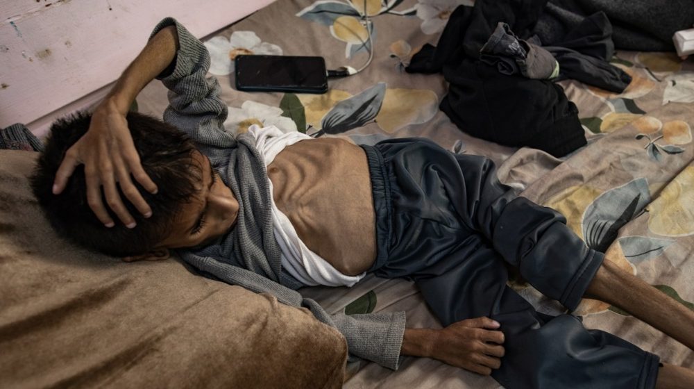 SZO: Neuhranjenost u Gazi dostigla alarmantan nivo 1