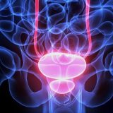 Rak prostate: Koji su simptomi i kako se leči 5