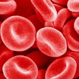 Svetski problem nedostatka gvožđa: Da li su suplementi rešenje 6