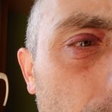 "Jajima gađaju naprednjaci, a ne građani": Nišlija Dušan Ilić prijavio policiji da ga je napala i povredila grupa Vučevih pristalica 9