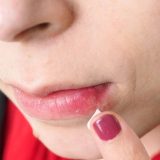 Herpes i Alchajmerova bolest: Dokazana je nova veza, da li treba da brinemo 2