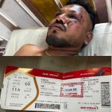 Putnik sa sedišta A11 čudom preživeo pad indijskog aviona 9