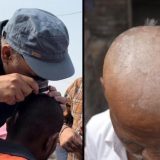 Misteriozni masovni gubitak kose - gljivice ili zagađenje 4