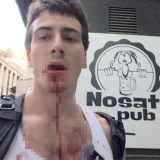 U Ćacilendu pretučen jutjuber: Nevenclips objašnjava za Danas šta se desilo u Pionirskom parku (VIDEO) 5