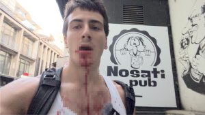 Jutjuber Neven Krstić poznatiji kao Nevenclips pretučen je u Pionirskom parku, gde je formirano kamp naselje 'Ćacilend'.