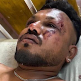 Čudo sa sedišta 11A: Ko je Višvakumar Rameš, jedini preživeli u avionskoj nesreći u Indiji? 10