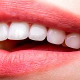 Estetika zuba - stomatološke ordinacije 5