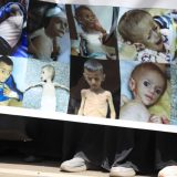 Usled neuhranjenosti umrlo 113 osoba u Gazi, od čega 81 dete 3