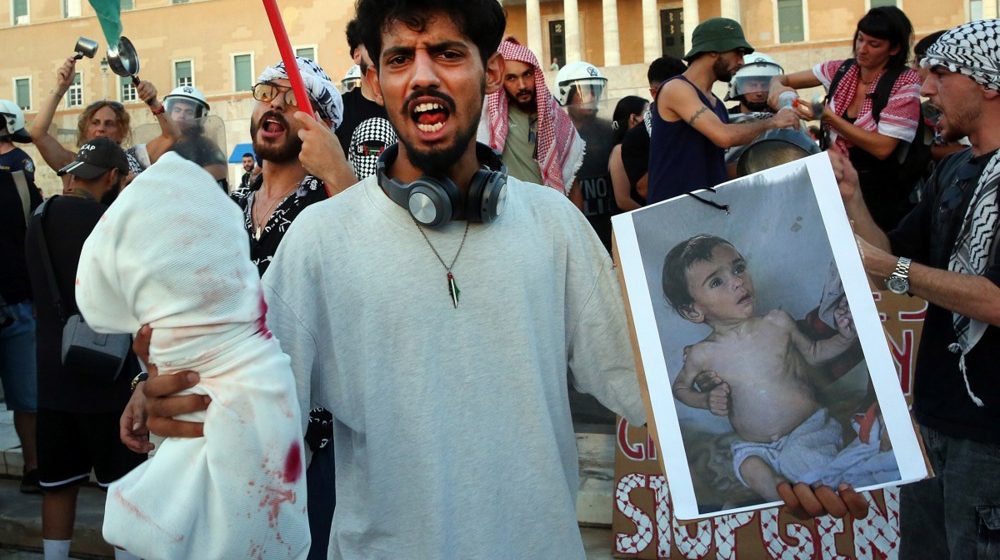 Medicinski radnici upozoravaju na ubrzano umiranje u Gazi od gladi: "Deca su toliko slaba da ne mogu da plaču ni da se pomeraju" 1