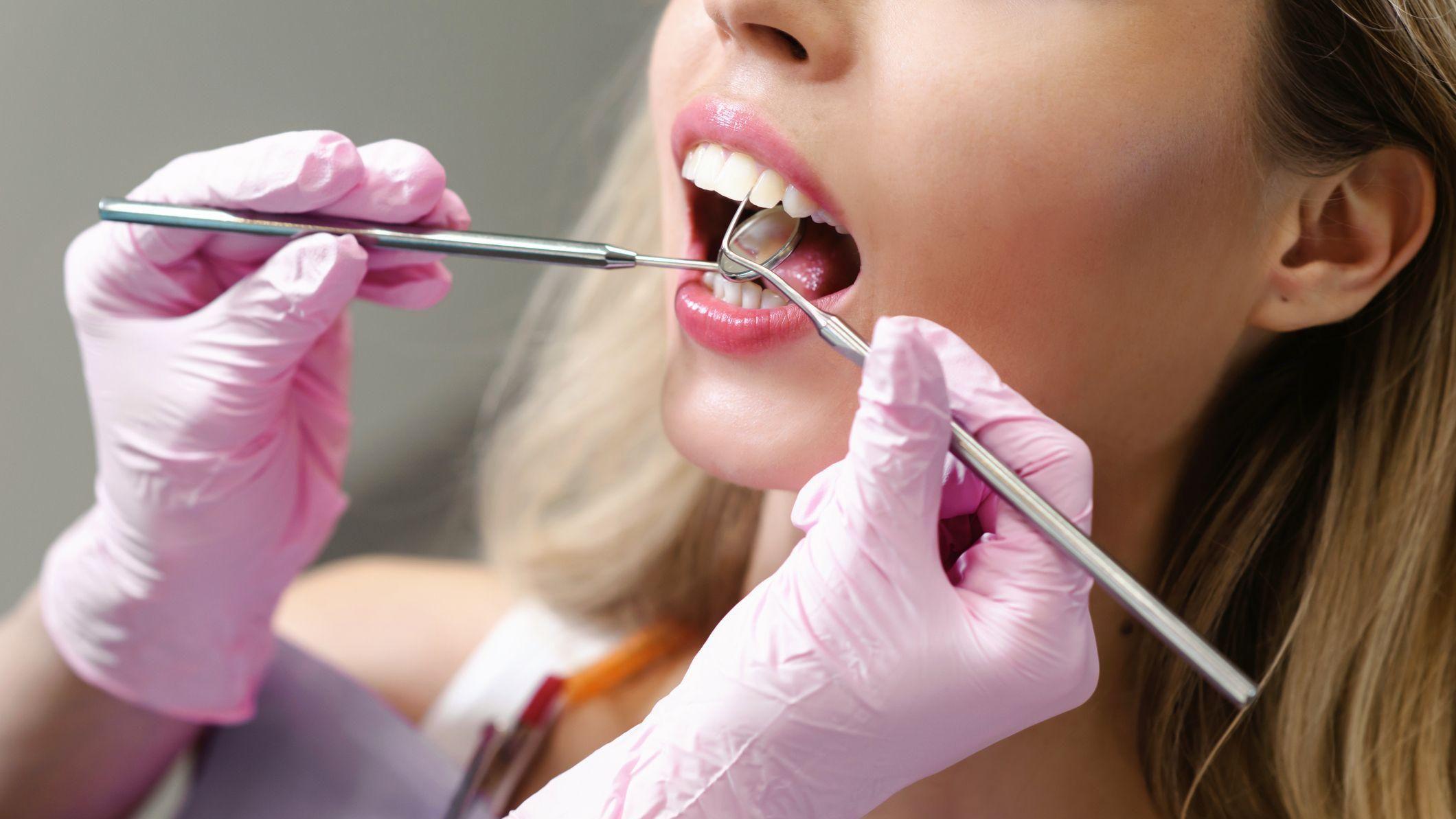 Mogu li zdrava pića da oštete zube 2 Stomatolog instrumentima pregleda devojci zube