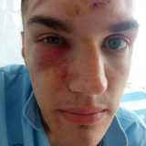 Optužbe o nasilju policije: Svedočenja povređenih na blokadama u Srbiji 7