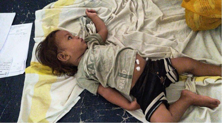 Jednogodišnje 'čudo od dečaka': Ugrizao kobru i usmrtio je 2 dečak u bolnici