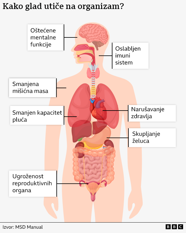 Ilustracija uticaja gladi na organizam
