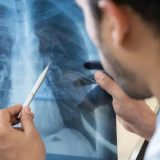 Šta je legionarska bolest koju izaziva bakterija legionela 8