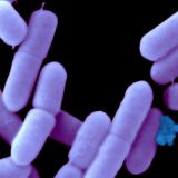 Listerija, bakterija koja opstaje i na hladnom 1