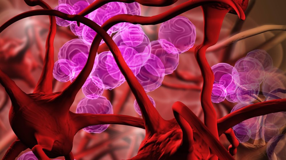 Stalno ste iscrpljeni i umorni, a kosa vam puca iako je redovno negujete: Prepoznajte simptome anemije 1