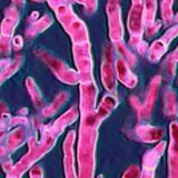 Možemo li da zaustavimo smrtonosne gljivice 9