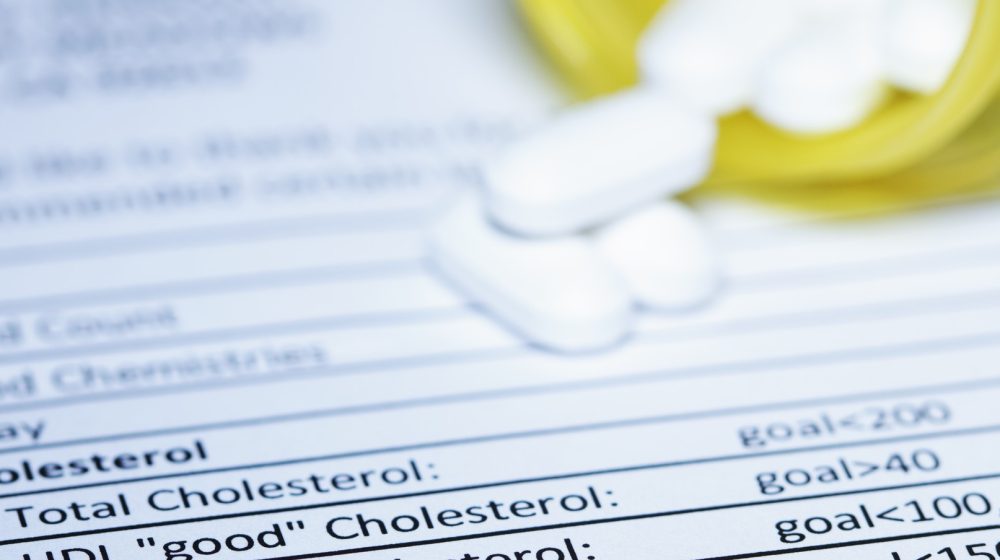 Sve što treba da znate ako uzimate statine za snižavanje holesterola 1