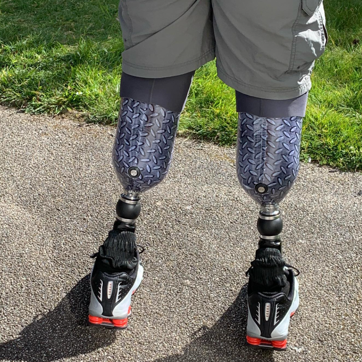 Bio je ugledan hirurg od poverenja, ali je lagao zašto je ostao bez nogu 3 Snimak Nil Hoperovih protetskih nogu snimljen otpozadi. Nosi crno-bele patike.