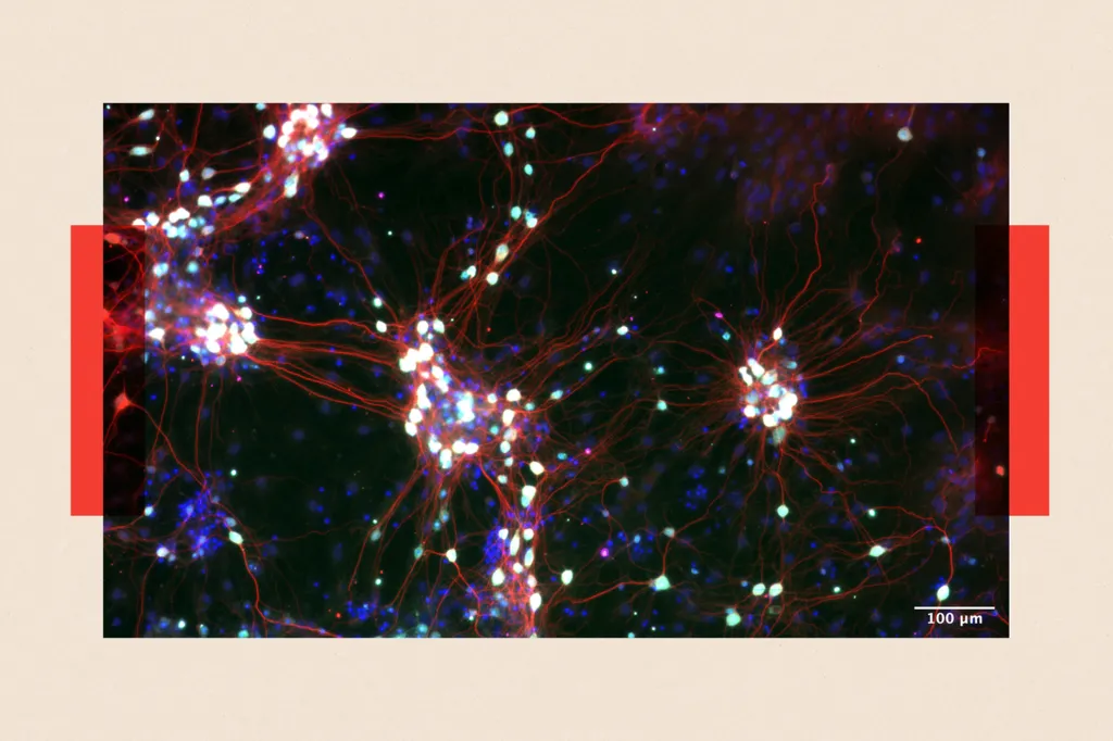 Može li veštačka inteligencija da postane svesna 6 Prikaz „organoida” koji se sastoje od nervnih ćelija