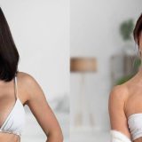 Zašto sve više žena uklanja silikone iz grudi 4