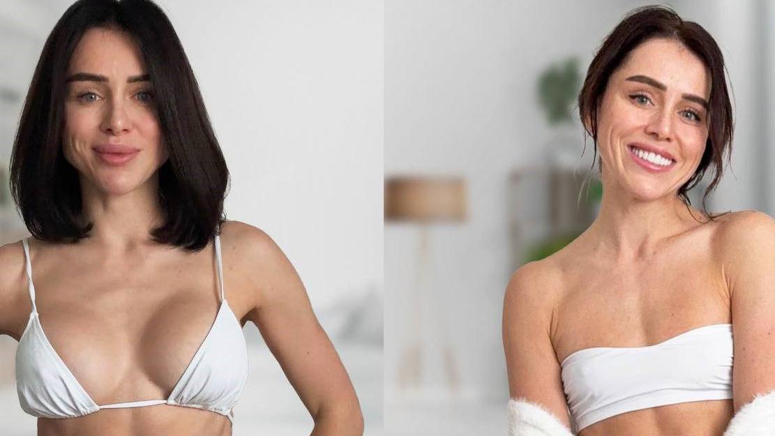 Crnokosa žena u belom bikiniju. Na levoj fotografiji sa silikonima u grudima, na desnoj bez silikona
