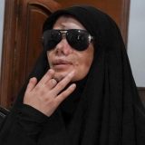 Žrtva izraelskog napada pejdžerima u Libanu: 'Moje oči su nestale' 6