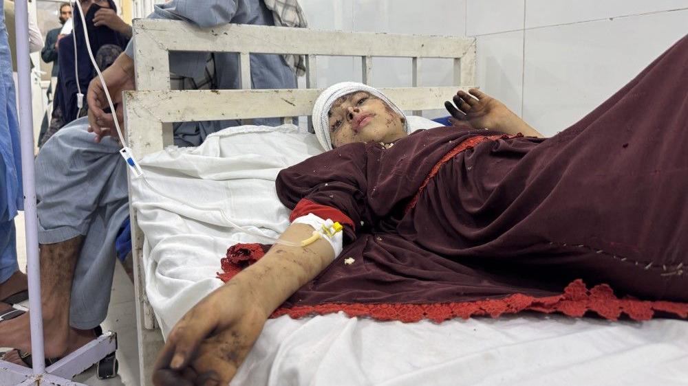 Stotine mrtvih i oko 2.800 povređenih u zemljotresu u Avganistanu, kažu vlasti 1 zemljotres u avganistanu, avganistan, zemljotres, povređena devojčica leži u bolnici