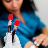 Revolucionarni test krvi mogao bi da otkrije 50 vrsta raka 4