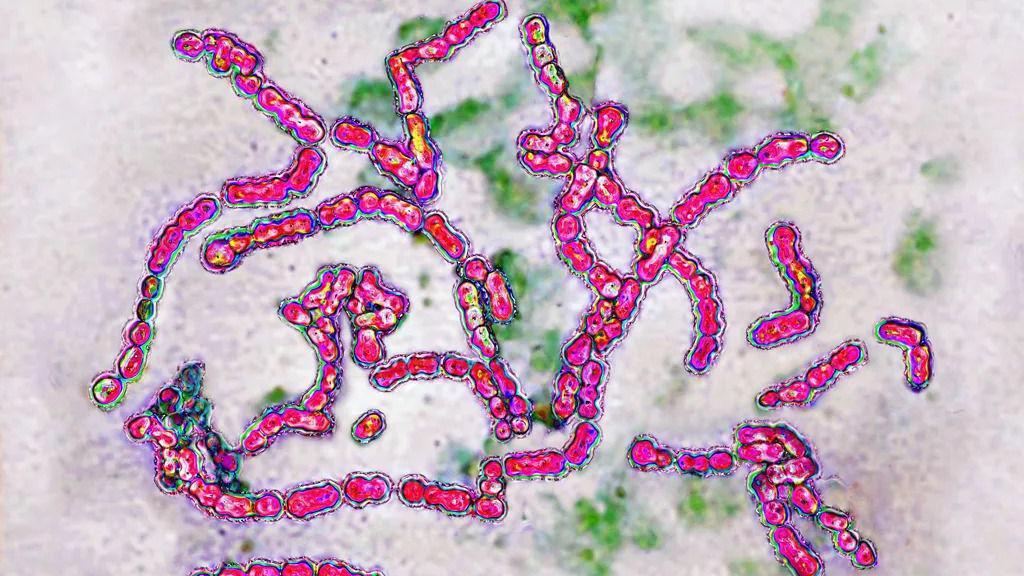 Mikroskopski prikaz bakterije streptokoke