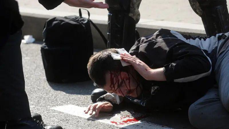 Može li Parada ponosa 2010. u Srbiji da se nazove Pirovom pobedom 5 Povređeni demonstrant