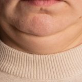 Šta obim vrata govori o vašem zdravlju 5