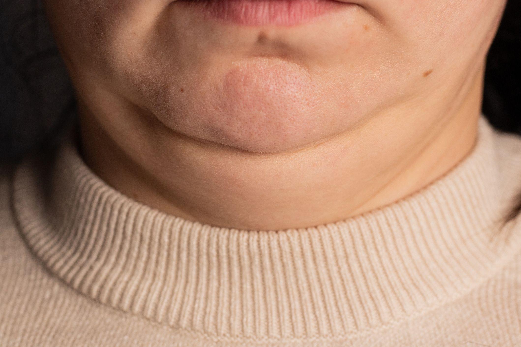 Šta obim vrata govori o vašem zdravlju 1 Vrat