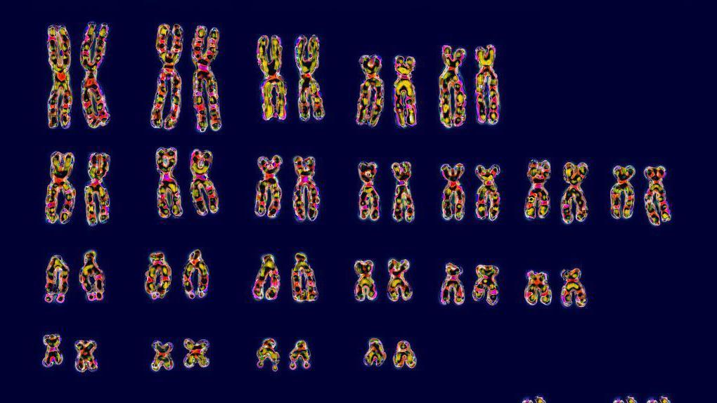 Slika kariotipa prikazuje 22 para hromozoma plus polne XY ili XX