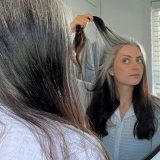 Kako nekima kosa posedi već u tinejdžerskom dobu 4