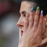 Šta nokti mogu da nam otkriju o našem zdravlju 6