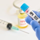 HPV