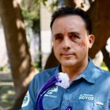 Čovek kom je ajkula poštedela život 7