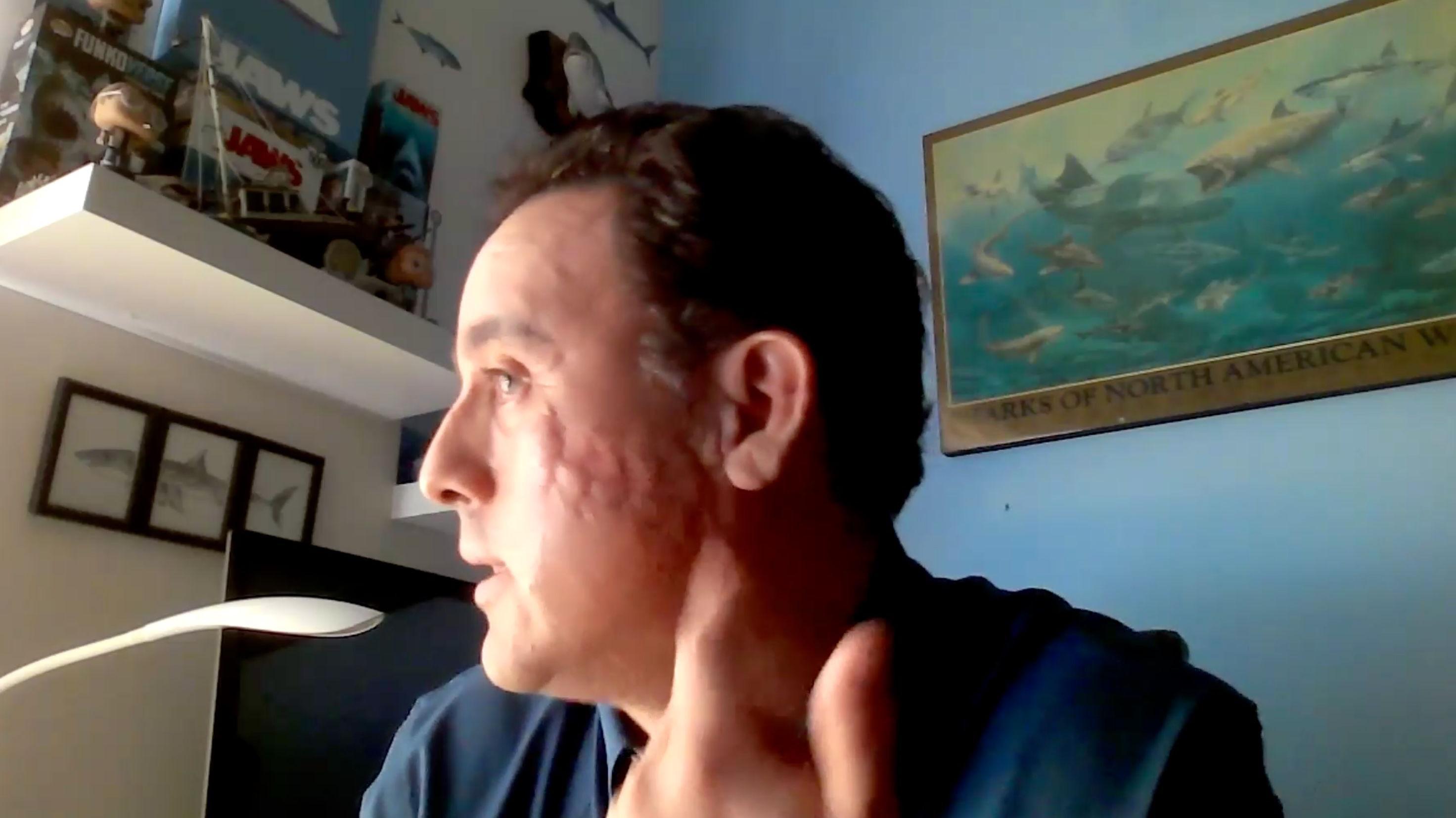 Hojos pokazuje na strani lica ugriz ajkule koji naziva ranom iz rata koja liči na škrge, iza njega na zidu su okačene slike riba