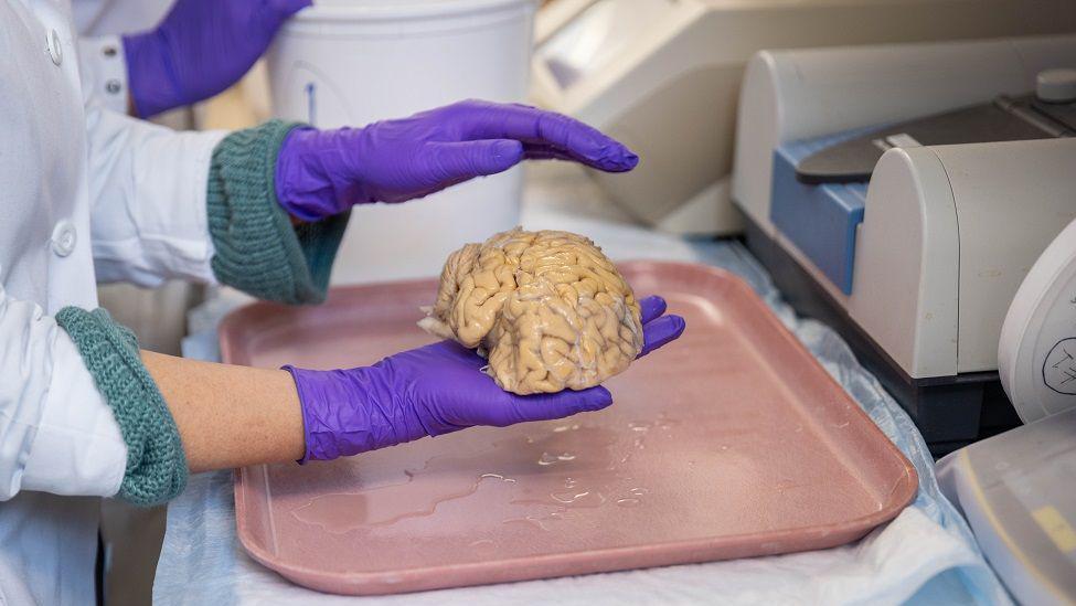 Mozak u ruci tokom istraživanja