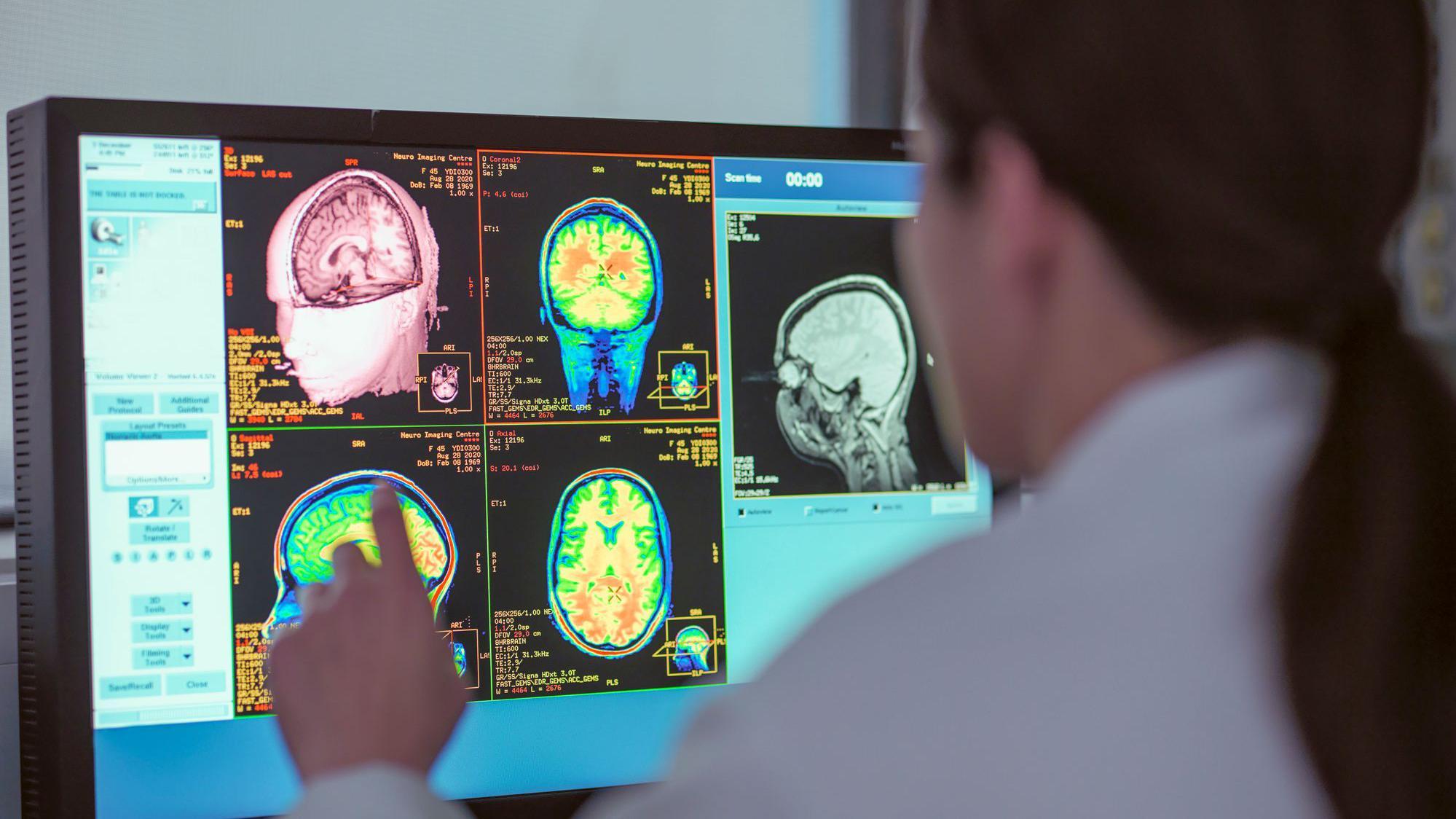 Докторот гледа во мониторот, има слика од мозокот на скенерот