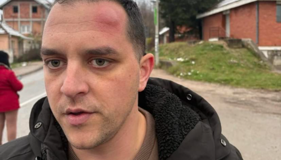 Poslanik ZLF koji je napadnut u Mionici: "Pribili su me uza zid i udarali šipkom" 1